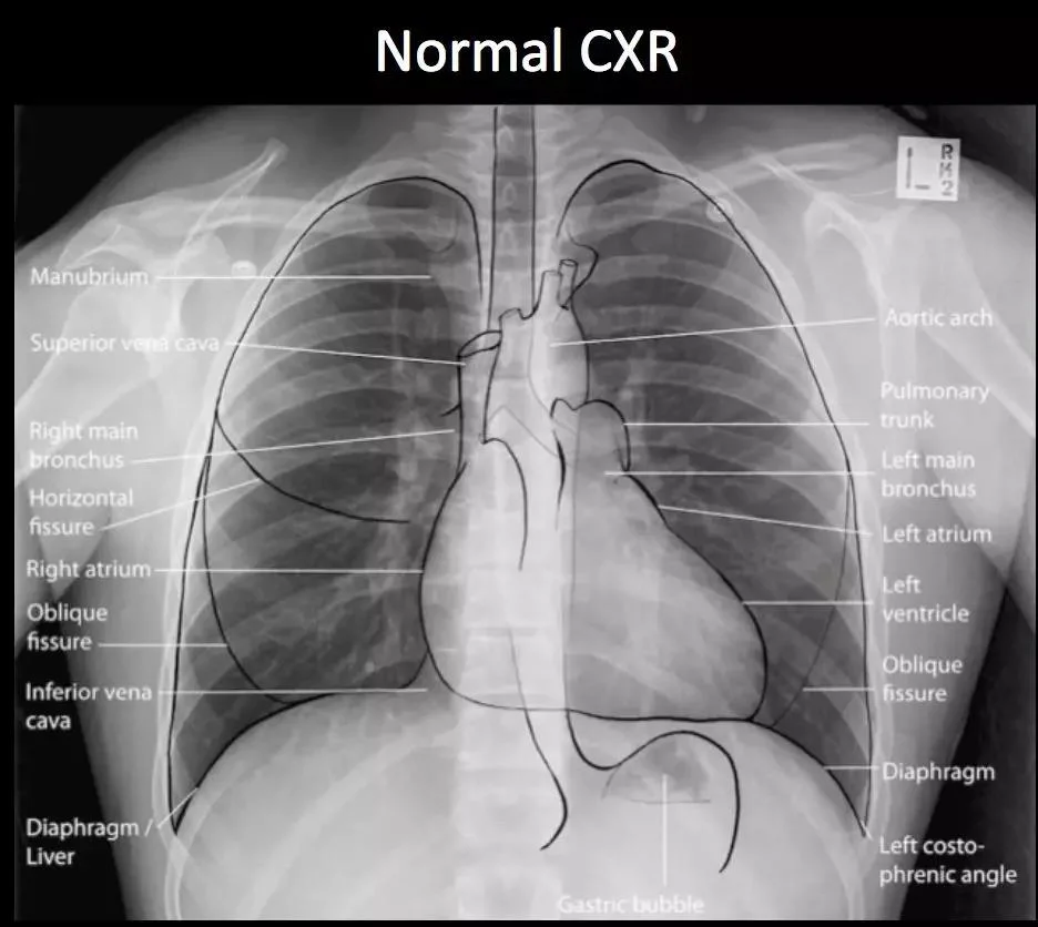 气囊压力监控仪.jpg 气囊压力监控仪.jpg