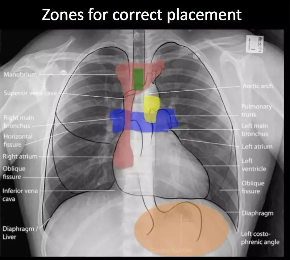 气囊压力监控仪.jpg 气囊压力监控仪.jpg