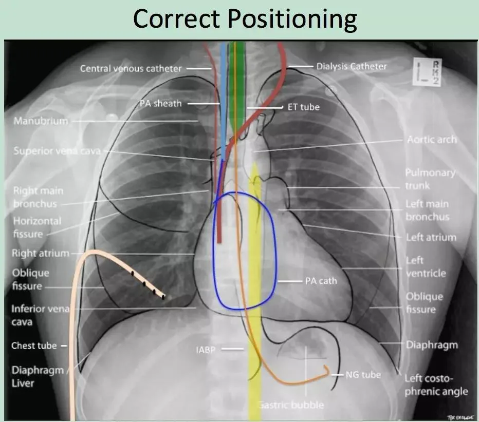 气囊压力监控仪.jpg 气囊压力监控仪.jpg